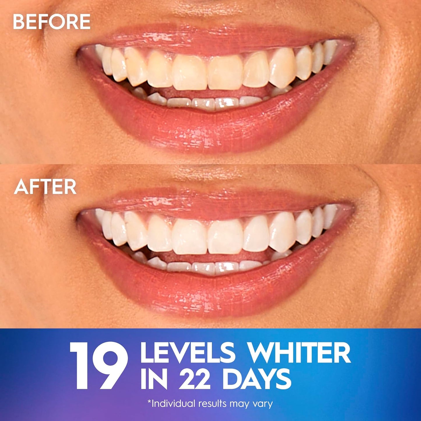 Crest 3D Whitestrips Professional Effects 44 Strips